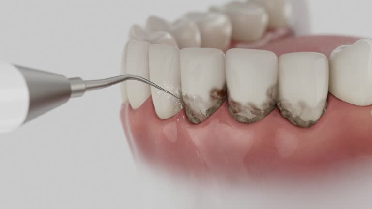 Trusted Tooth Extraction service in Auburn, KY - Dentist Open Now
